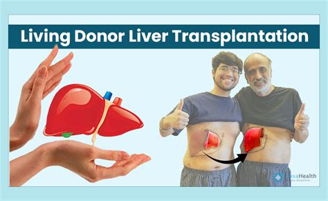 liver transplant near roseville|Liver Transplant .